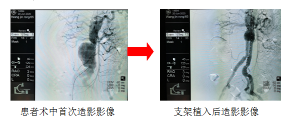 QQ截图20200707155605.png QQ截图20200707155605.png