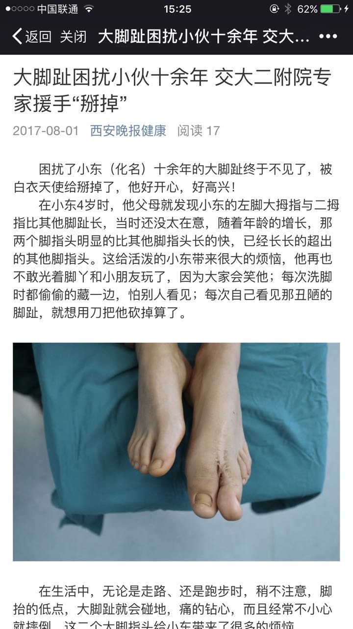 2017年8月1日 西安晚报健康：大脚趾困扰小伙十余年 交大二附院专家援手“掰掉”.jpg