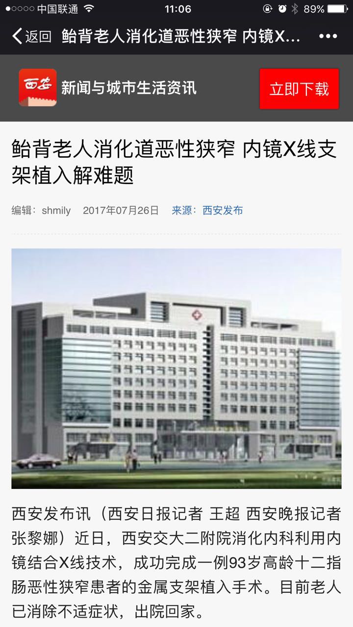 2017年7月26日 西安城市与生活资讯：鲐背老人消化道恶性狭窄 内镜X线支架植入解难题.jpg