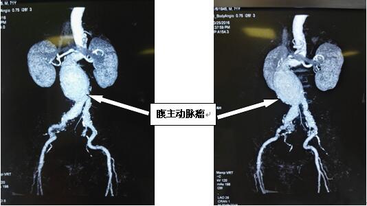 QQ截图20161104155902.jpg