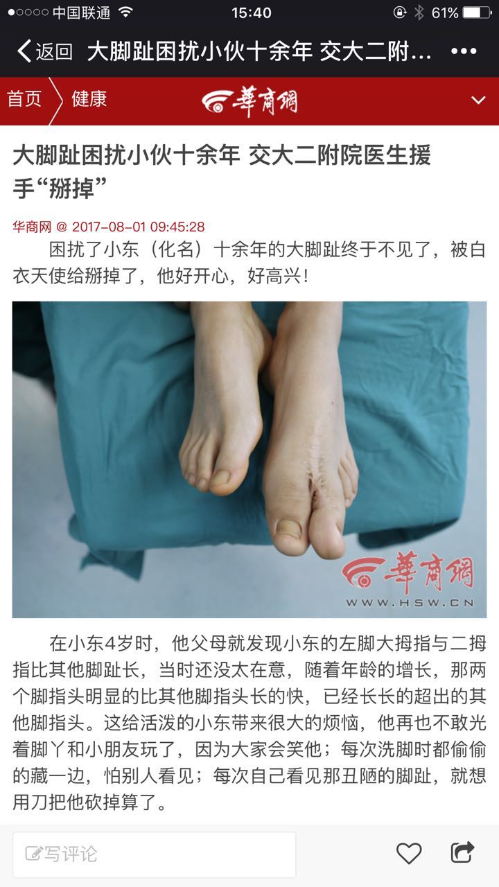 2017年8月1日 华商网：大脚趾困扰小伙十余年 交大二附院医生援手“掰掉”.jpg