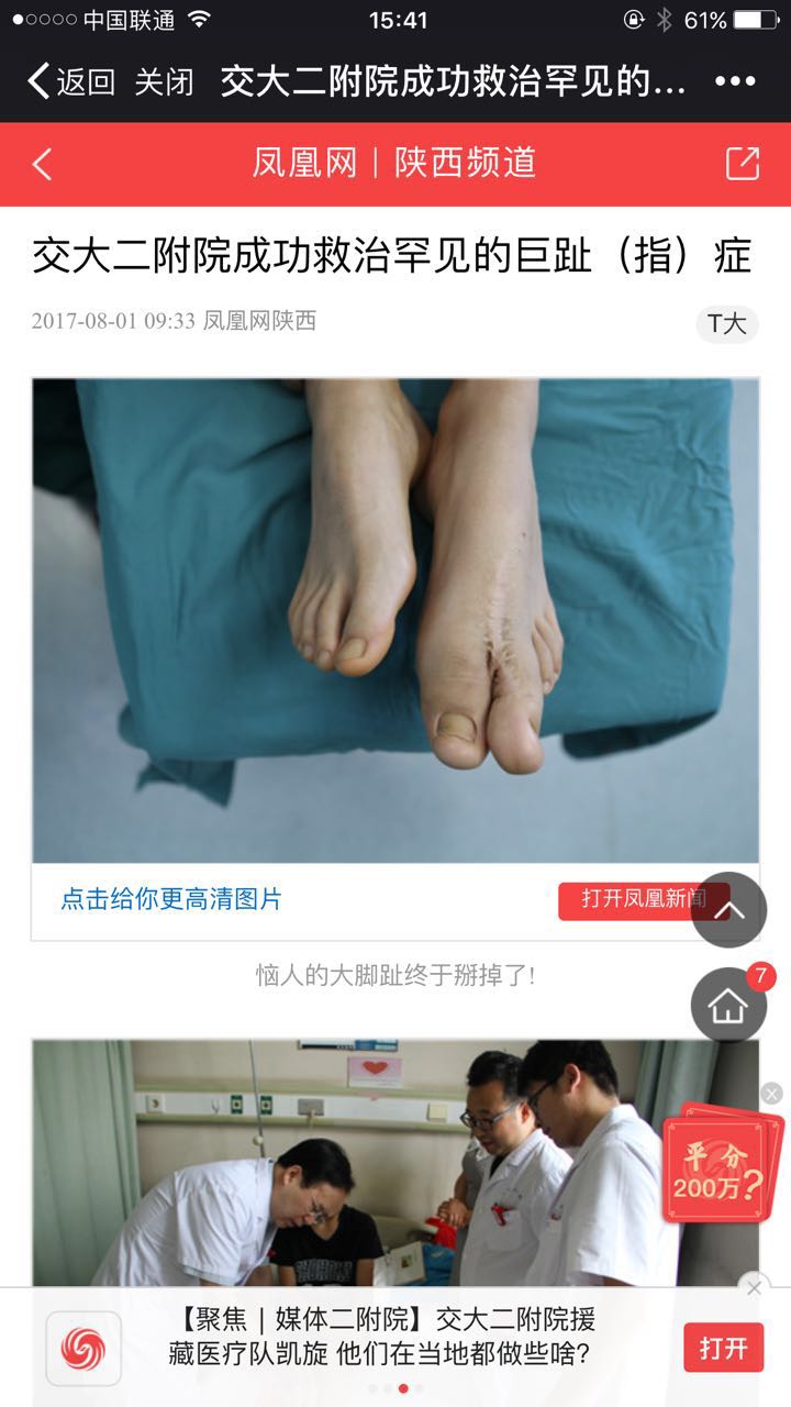2017年8月1日 凤凰网：交大二附院成功救治罕见的巨趾症.jpg