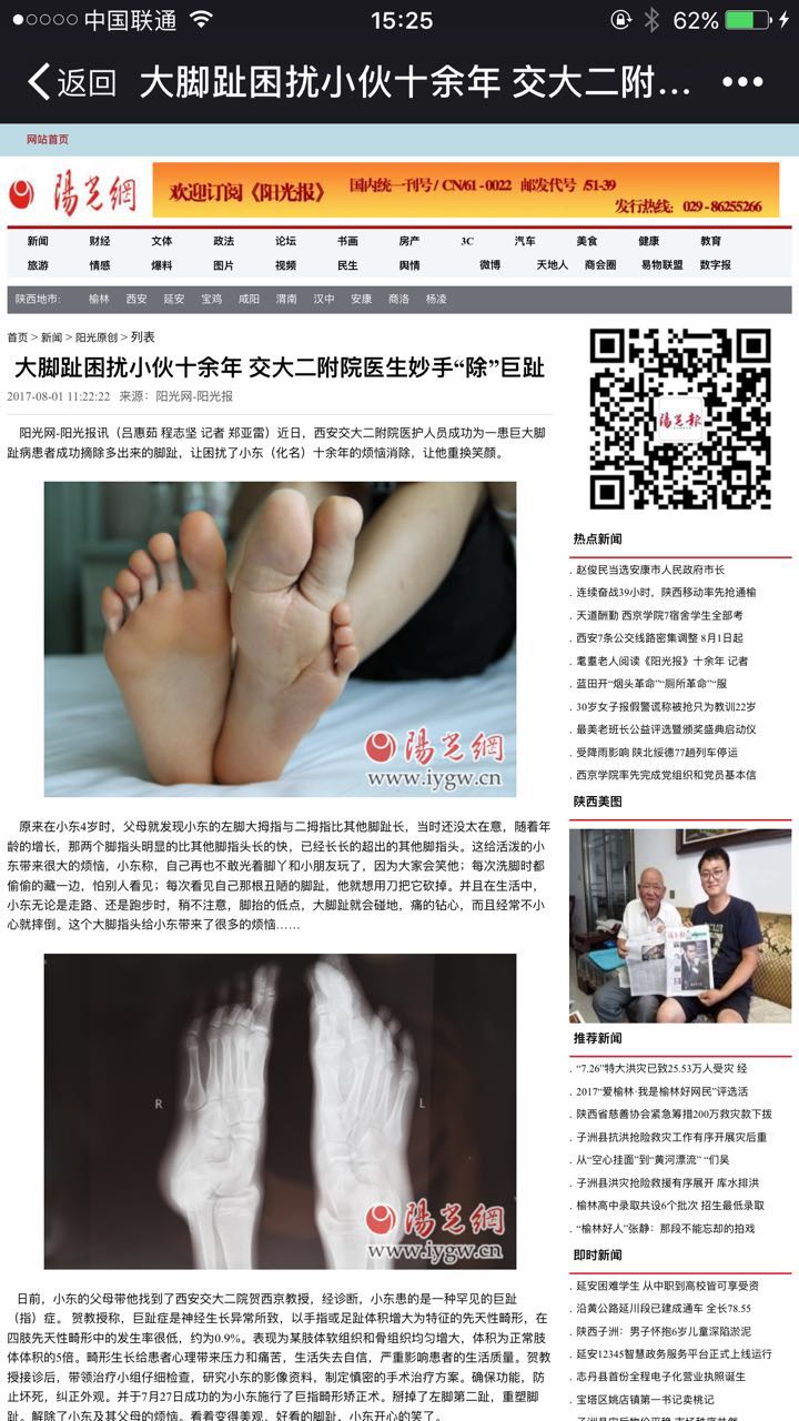 2017年8月1日 阳光网：大脚趾困扰小伙十余年 交大二附院医生妙手“除”巨趾.jpg
