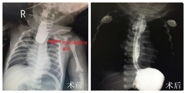 术后_副本.jpg