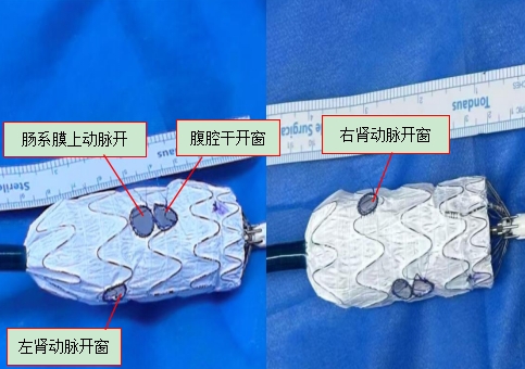 微信截图_20250303152154.png