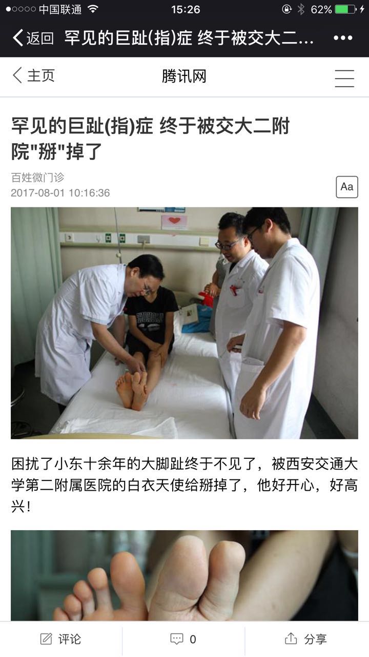 2017年8月1日 腾讯网：罕见的巨趾症终于被交大二附院掰掉了.jpg